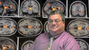 Brain Blood Flow Patterns Sexual Dysfunction